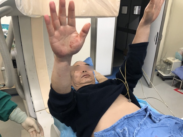 患者恢复状态.jpg